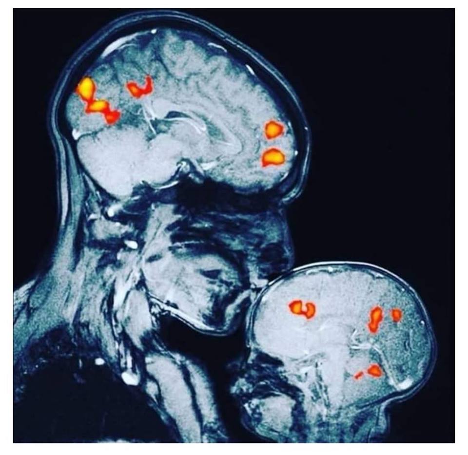 #JFR2019 | J-14 AVANT D’AVOIR LE PLAISIR DE VOUS ACCUEILLIR SUR LES JOURNÉES FRANCOPHONES DE RADIOLOGIE